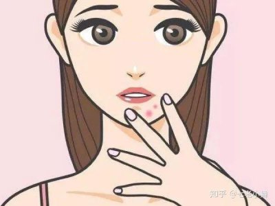 ​下巴长痘痘怎么治疗 下巴长痘痘，试试这个方法