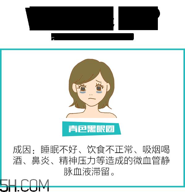 黑眼圈怎么去除既简单有容易 看类型与程度