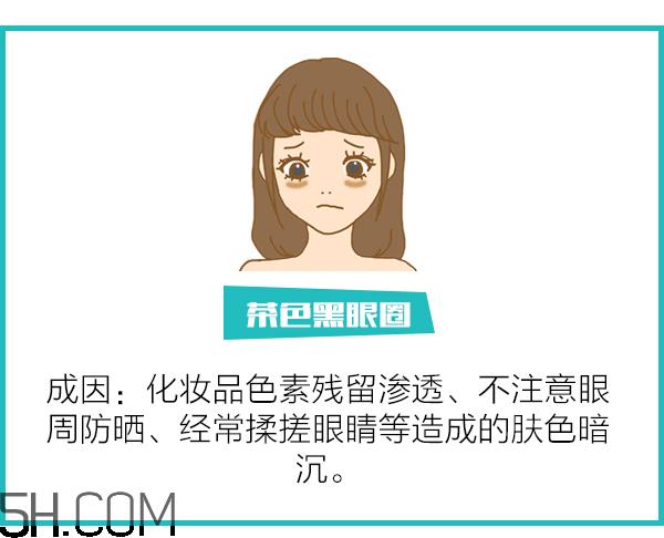 黑眼圈怎么去除既简单有容易 看类型与程度