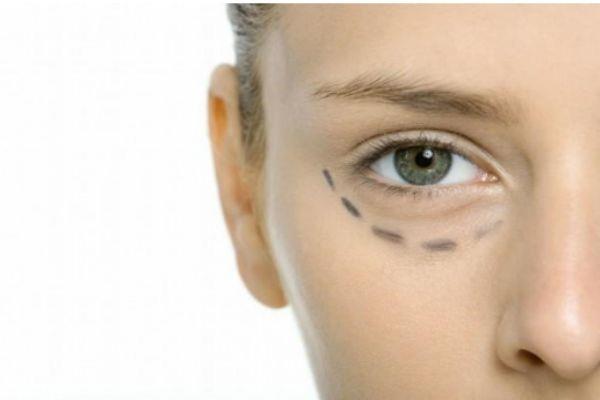 怎样去眼袋和黑眼圈 祛黑眼圈和眼袋的方法 怎样去眼袋和黑眼圈 祛黑眼圈和眼袋的方法