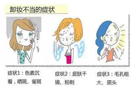 怎么卸妆才能卸干净又不伤皮肤 让你真正拥有干净肌肤 怎么卸妆才能卸干净又不伤皮肤 让你真正拥有干净肌肤