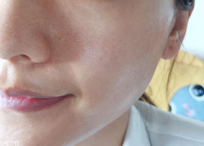 tripollar stop童颜机好用吗 tripollar stop美容仪怎么用 tripollar stop童颜机好用吗 tripollar stop美容仪怎么用