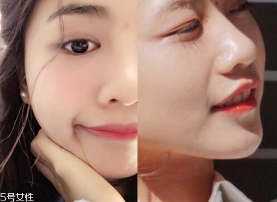 tripollar stop童颜机好用吗 tripollar stop美容仪怎么用 tripollar stop童颜机好用吗 tripollar stop美容仪怎么用