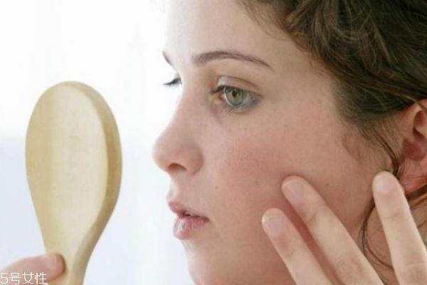 干皮为什么还长痘 干皮长痘痘的原因