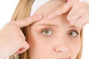 油痘皮适合什么护肤品?控油爽肤水不能少 油痘皮适合什么护肤品?控油爽肤水不能少