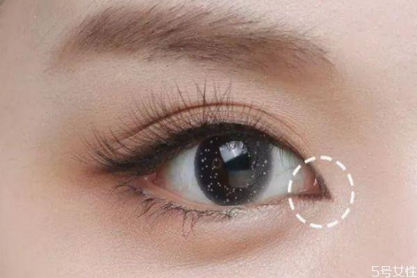 眼距宽怎么改善 怎样改善眼距过宽