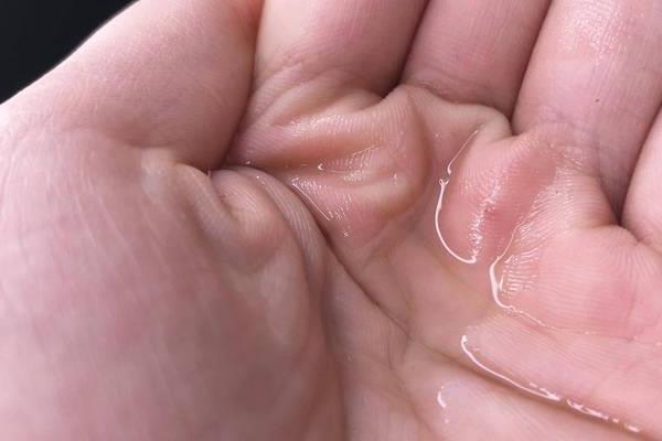 贝德玛洁肤液有什么用 贝德玛洁肤液好吗 贝德玛洁肤液有什么用 贝德玛洁肤液好吗