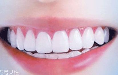 牙膏洁净剂有哪些 2种成分会加重口腔溃疡 牙膏洁净剂有哪些 2种成分会加重口腔溃疡