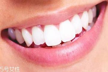 牙膏洁净剂有哪些 2种成分会加重口腔溃疡 牙膏洁净剂有哪些 2种成分会加重口腔溃疡