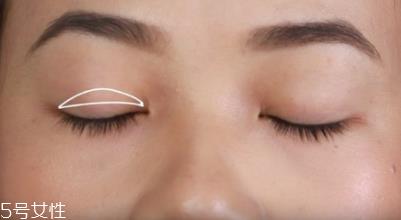 双眼皮贴单面好还是双面好 适合不同的人