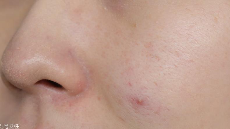 兰蔻气垫素颜霜怎么样？遮瑕度不够