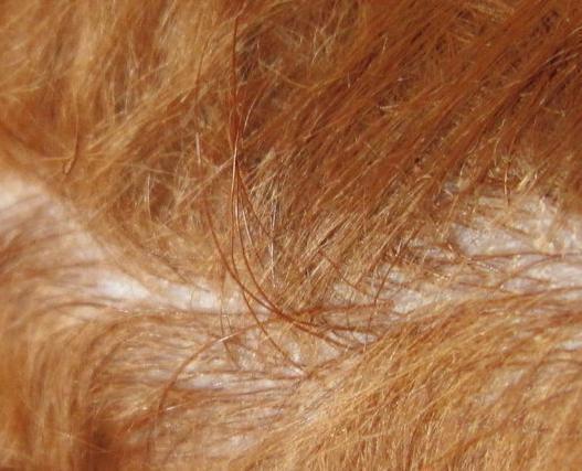 女孩冬天给泰迪剃毛,没想到不但没提升颜值,还生出了“变态毛”