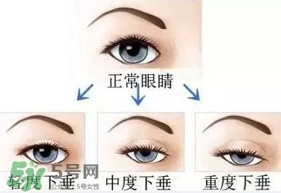 长期用假睫毛双眼皮贴对眼睛有什么伤害? 长期用假睫毛双眼皮贴对眼睛有什么伤害?