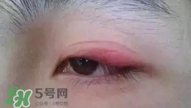 长期用假睫毛双眼皮贴对眼睛有什么伤害? 长期用假睫毛双眼皮贴对眼睛有什么伤害?