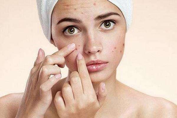 痘印消失的时间跟肤色有关吗 痘印要多久能消除 痘印消失的时间跟肤色有关吗 痘印要多久能消除