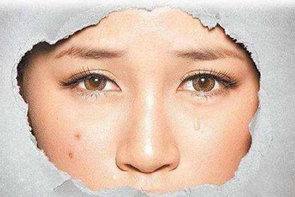 痘印消失的时间跟肤色有关吗 痘印要多久能消除 痘印消失的时间跟肤色有关吗 痘印要多久能消除