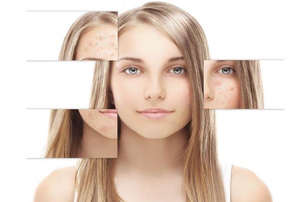 烟酰胺能白天用吗 烟酰胺使用禁忌 烟酰胺能白天用吗 烟酰胺使用禁忌