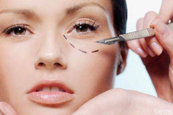 什么是泪沟纹呢 泪沟纹是怎么形成的呢 什么是泪沟纹呢 泪沟纹是怎么形成的呢