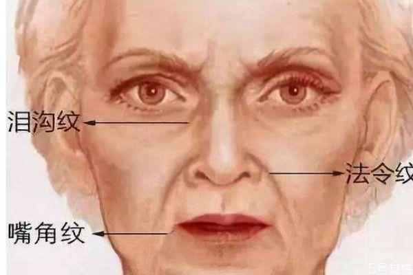 什么是泪沟纹呢 泪沟纹是怎么形成的呢 什么是泪沟纹呢 泪沟纹是怎么形成的呢