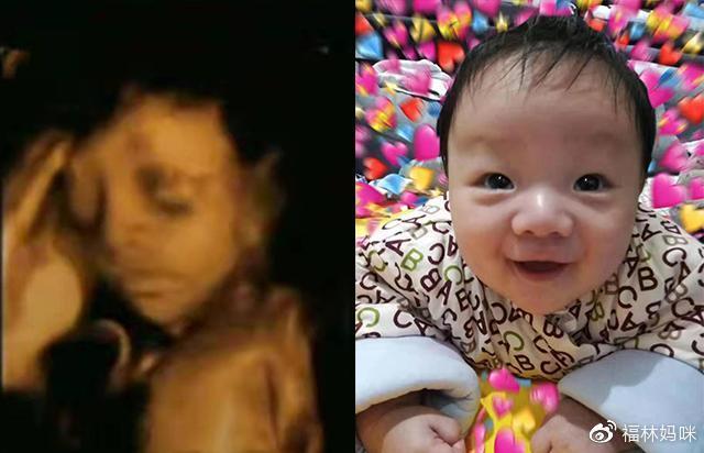 四维彩超跟实际长相有没有差别?宝妈:当初高鼻梁,出来塌鼻梁