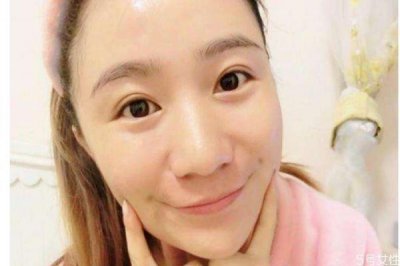 ​学生怎样去痘痘和痘印 学生去痘痘和痘印方法