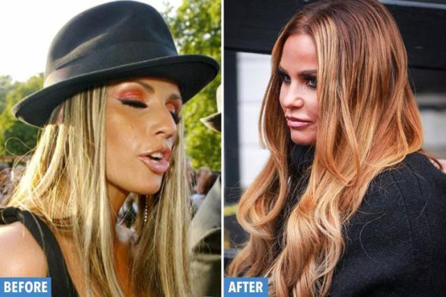 整容狂人为青春不老，花费440万元整容，至今整容了20年