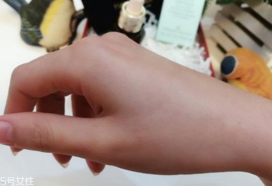 雅诗兰黛适合痘痘肌吗? 雅诗兰黛适合痘痘肌吗?