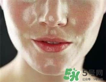 怎么样通过饮食改善油性皮肤?油性皮肤的食物 怎么样通过饮食改善油性皮肤?油性皮肤的食物