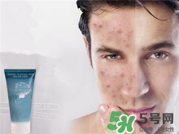 怎么样通过饮食改善油性皮肤?油性皮肤的食物 怎么样通过饮食改善油性皮肤?油性皮肤的食物