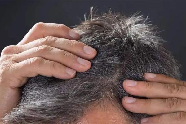 白头发越来越多是身体哪里有问题 白头发多和肾虚有关系吗 白头发越来越多是身体哪里有问题 白头发多和肾虚有关系吗