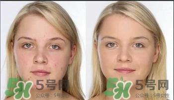 遮瑕膏会堵塞毛孔吗?遮瑕膏会不会堵塞毛孔? 遮瑕膏会堵塞毛孔吗?遮瑕膏会不会堵塞毛孔?