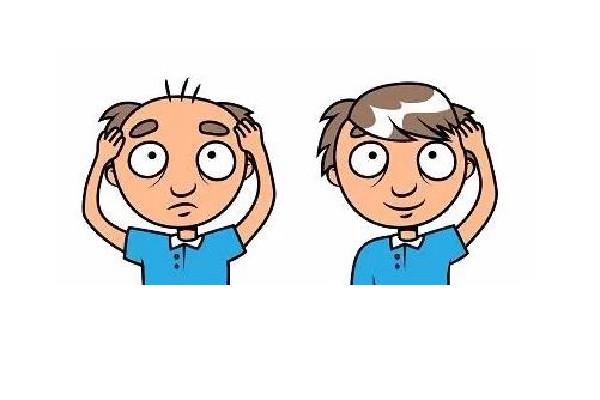 掉发能用生姜洗发水吗 掉发用生姜洗发水管用吗