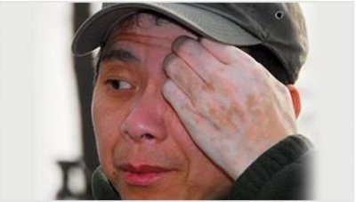 ​什么灵丹妙药治好了冯小刚的白癜风？