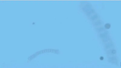 ​发呆时眼前出现的漂浮物是什么？