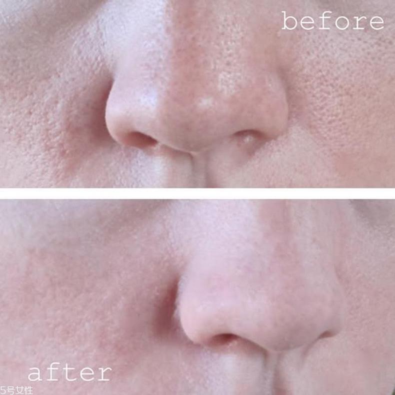 dr.brandt毛孔隐形妆前乳怎么样？用来打底不浮粉