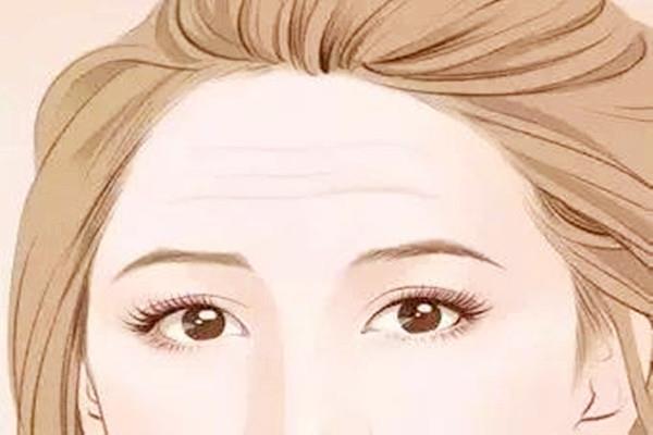 抬头纹可以打肉毒素吗 抬头纹可以打除皱针吗 抬头纹可以打肉毒素吗 抬头纹可以打除皱针吗