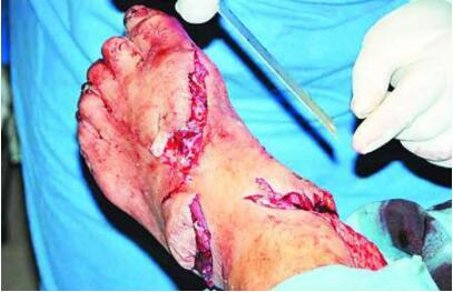 表露鲨作家全力于鲨鱼维护团队