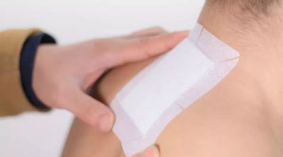 膏药怎么洗 教您如何妙招清洗膏药印记