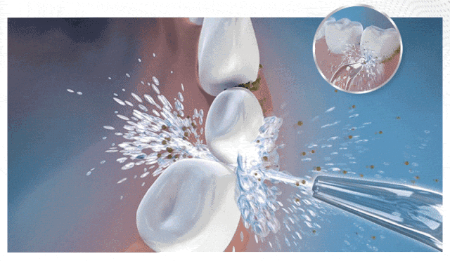 牙齿松动怎么办教你一招自愈(牙齿松动别急着拔)(3)