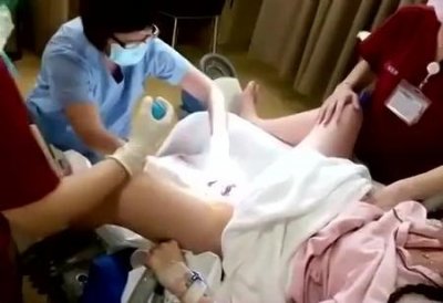 剖腹产双胎需要多少钱(双胎剖腹产费用)