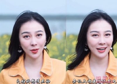 ​叶璇近照疑整容 看起来太网红脸了