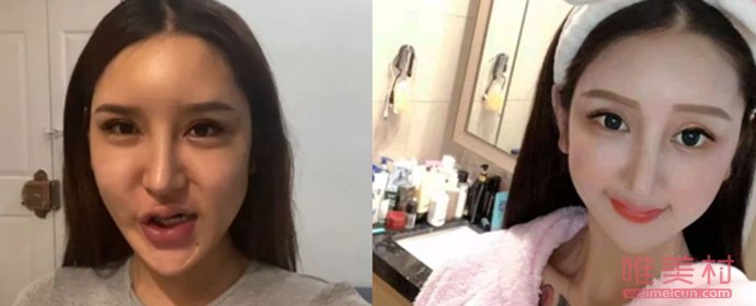 网红桃花宝宝整容失败 脸简直吓死人