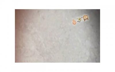 做梦遗精怎么办?