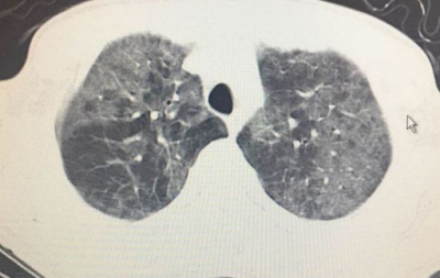 pj是什么意思(pi币最新消息)