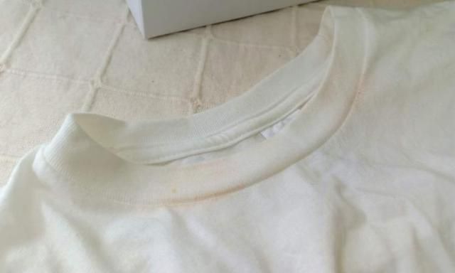 白裤子上黄渍怎样清除